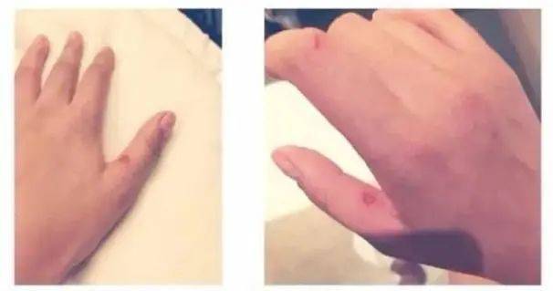 女子肩胛骨灵活到能夹死苍蝇