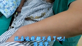 过度防晒致翻身骨折