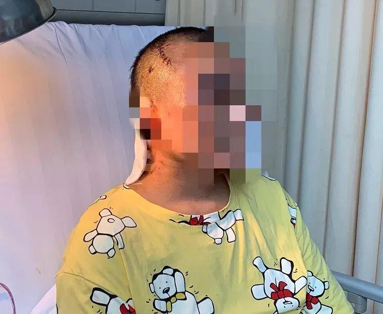 儿子中1000万 父亲生疑砍伤前妻