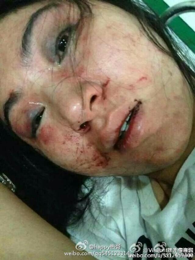 女老板被醉酒顾客打后还击改判无罪